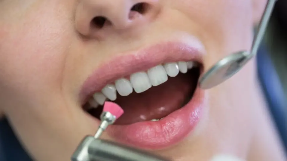 Professional Teeth Cleaning vs. At-Home Care What's the Difference