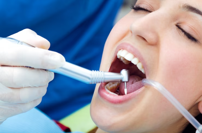 Teeth Cleaning - JB Dentistry