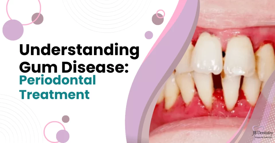 Understanding Gum Disease Periodontal Treatment