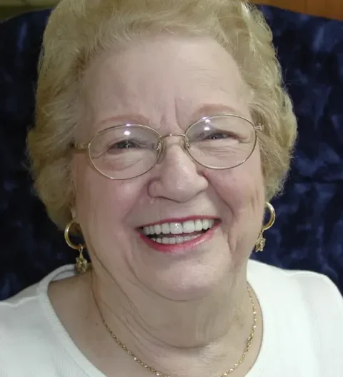 Invisalign with front teeth bonding after