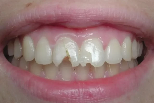 jackie-closeup-before